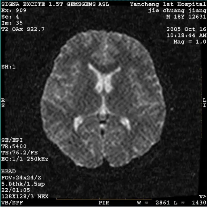 ARTIFACT WI/Fiesta Gambar Putih Piksel